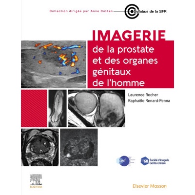 Imagerie de la prostate et des organes génitaux de l'homme