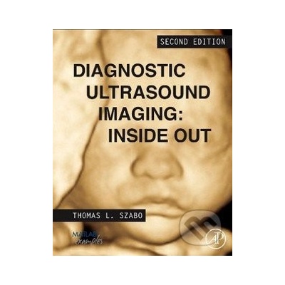 Diagnostic Ultrasound Imaging: Inside Out Szabo Thomas