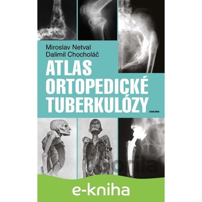 Atlas ortopedické tuberkulózy - Dalimil Chocholáč, Miroslav Netval