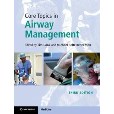 Core Topics in Airway Management | Michael Kristensen