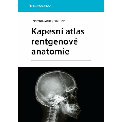 Kapesní atlas rentgenové anatomie - Torsten B. Möller
