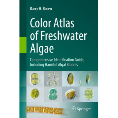 Common and Rare Freshwater Algae