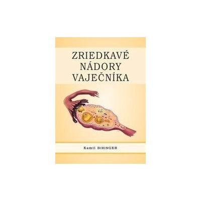 Zriedkavé nádory vaječníka - Kamil Biringer