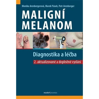 Maligní melanom
