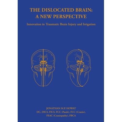 Dislocated Brain: A New Perspective | Jonathan Howat, Mandy Miller