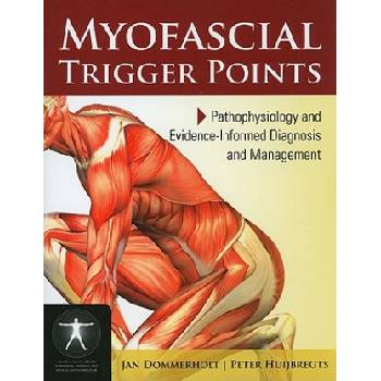 Myofascial Trigger Points: Pathophysiology And Evidence-Informed Diagnosis And Management | Jan Dommerholt, Peter Huijbregts