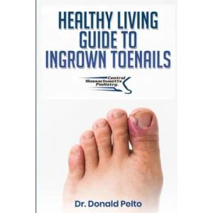 The Healthy Living Guide to Ingrown Toenails | Donald Pelto (ISBN: 9781697325386)