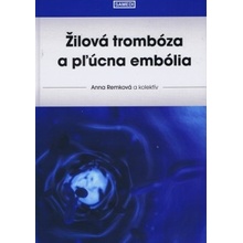 Žilová trombóza a pľúcna embólia - Anna Remková