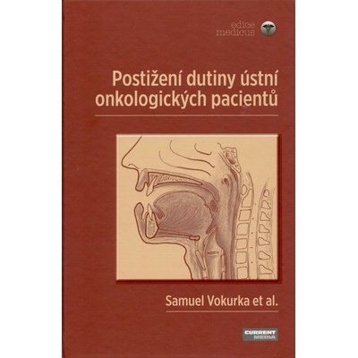 Postižení dutiny ústní onkologických pacientů