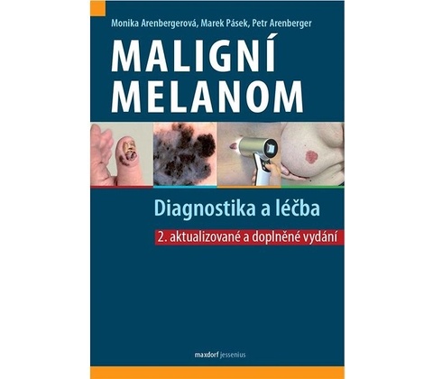 Maligní melanom