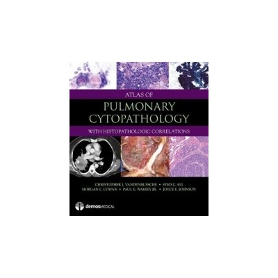 Atlas of Pulmonary Cytopathology Vandenbussche Christopher J.Pevná vazba