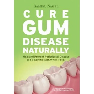 Cure Gum Disease Naturally | Ramiel Nagel (ISBN: 9780982021361)