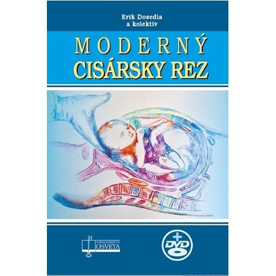 Moderný cisársky rez + CD