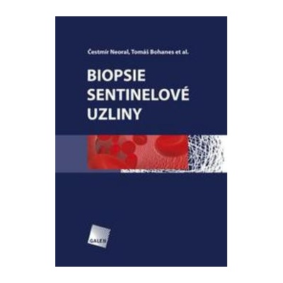 Biopsie sentinelové uzliny - Čestmír Neoral
