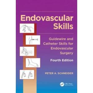 Endovascular Skills | Schneider, Peter (ISBN: 9781482217377)