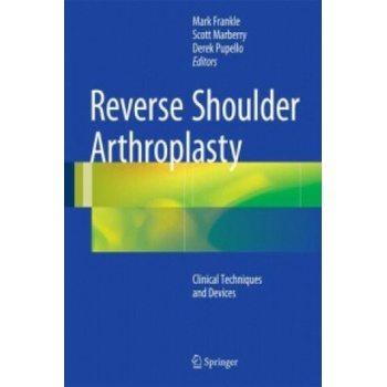 Reverse Shoulder Arthroplasty
