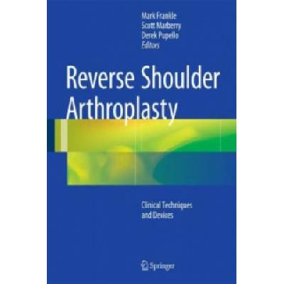 Reverse Shoulder Arthroplasty