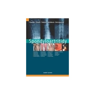 Spondyloartritidy