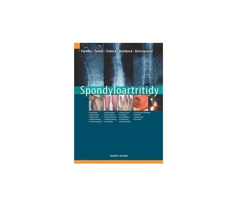 Spondyloartritidy