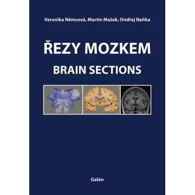 Řezy mozkem - Martin Mašek, Ondřej Naňka, Veronika Němcová