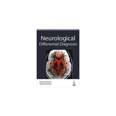 Differential Diagnosis in Neurology