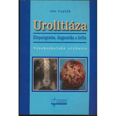 Urolitiáza. Etiopatogenéza, diagnostika a liečba - Ján Ľupták