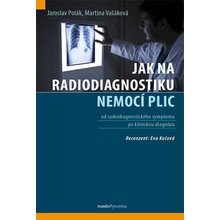 Jak na radiodiagnostiku nemocí plic