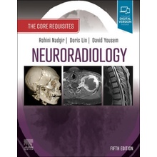 Neuroradiology