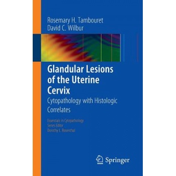 Glandular Lesions of the Uterine Cervix | Rosemary H. Tambouret, David C. Wilbur