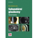 Sekundární glaukomy