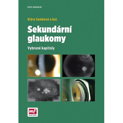 Sekundární glaukomy