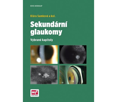 Sekundární glaukomy