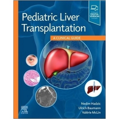 Pediatric Liver Transplantation - A Clinical Guide Hadzic NedimPevná vazba