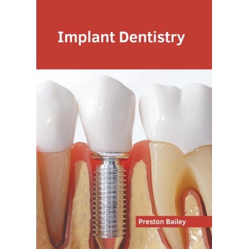 Implant Dentistry