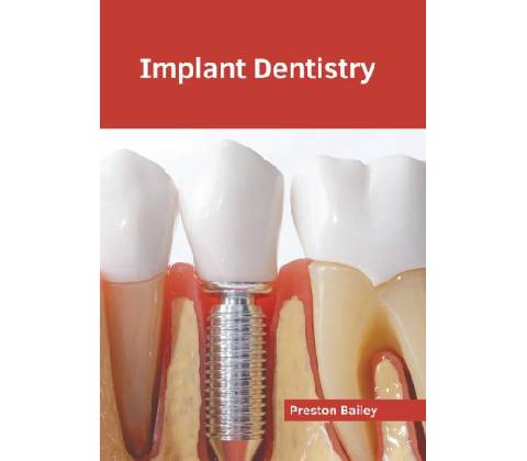 Implant Dentistry