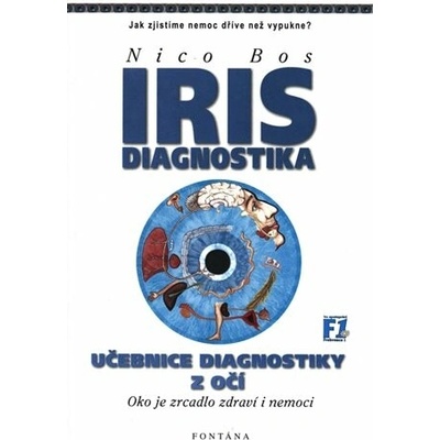 IRIS Diagnostika