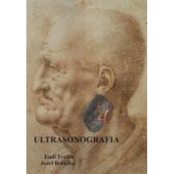 Ultrasonografia