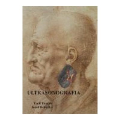 Ultrasonografia