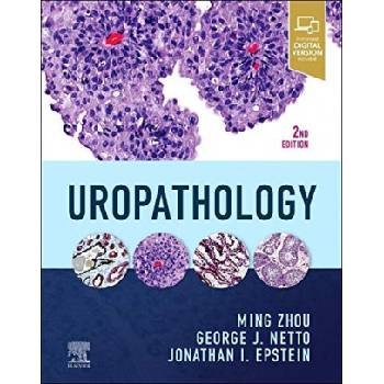 Uropathology | Ming Zhou, George Netto, Jonathan I Epstein