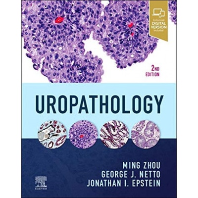 Uropathology | Ming Zhou, George Netto, Jonathan I Epstein