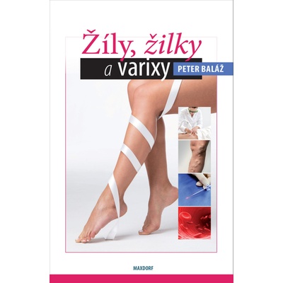 Žíly, žilky, varixy - Peter Baláž