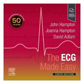 The ECG Made Easy