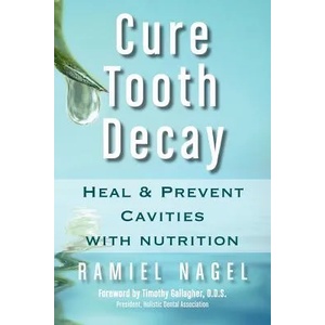 Cure Tooth Decay | Ramiel Nagel (ISBN: 9780982021309)