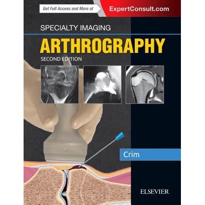 Specialty Imaging: Arthrography - Julia R. Crim
