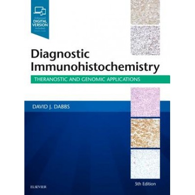 Diagnostic Immunohistochemistry - Theranostic and Genomic Applications Pevná vazba