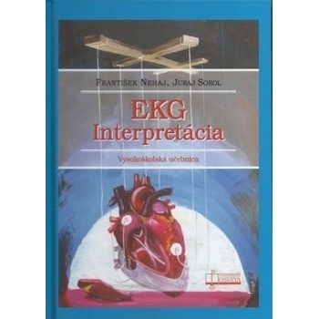 EKG interpretácia