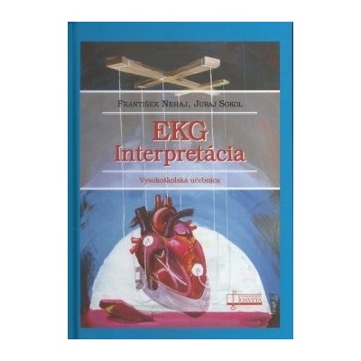 EKG interpretácia