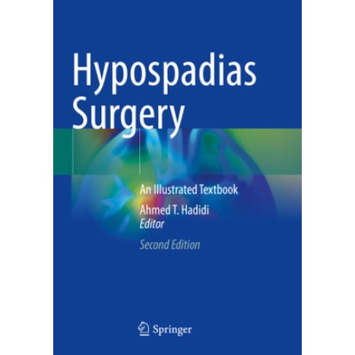 Hypospadias Surgery | Ahmed T. Hadidi