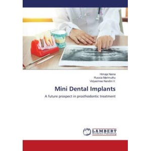 Mini Dental Implants | Russia Marimuthu, Vidyashree Nandini V (ISBN: 9786206846451)