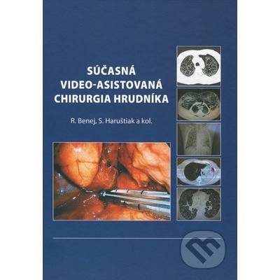 Súčasná video-asistovaná chirurgia hrudníka - Roman Benej, Svetozár Haruštiak